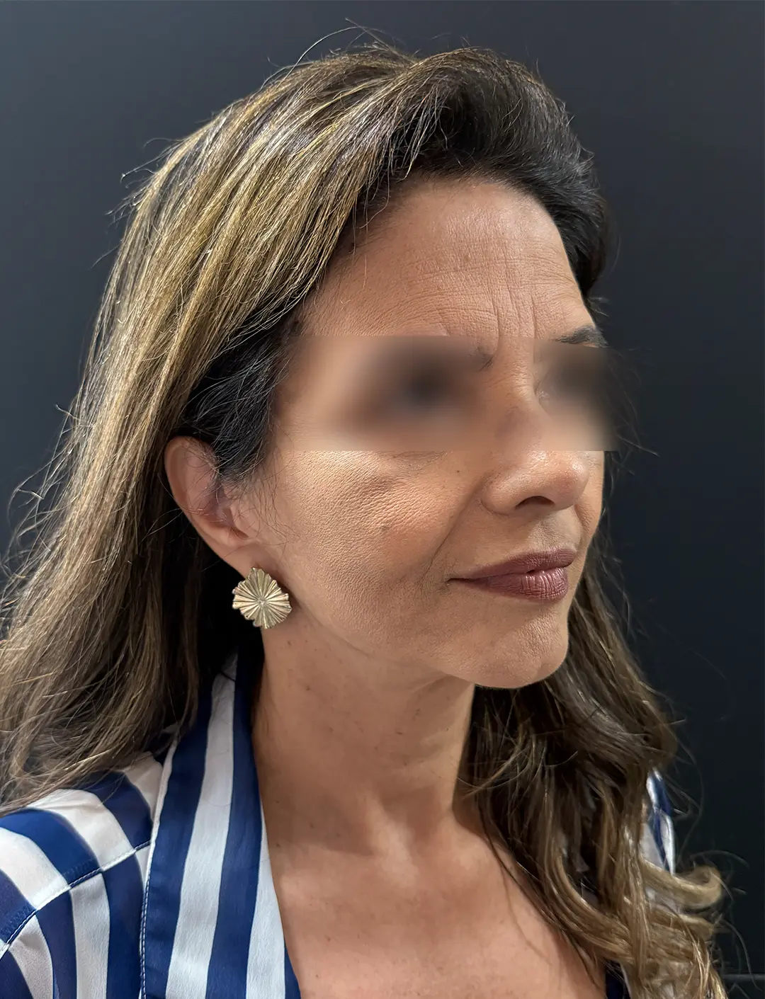 mulher antes mulher antes