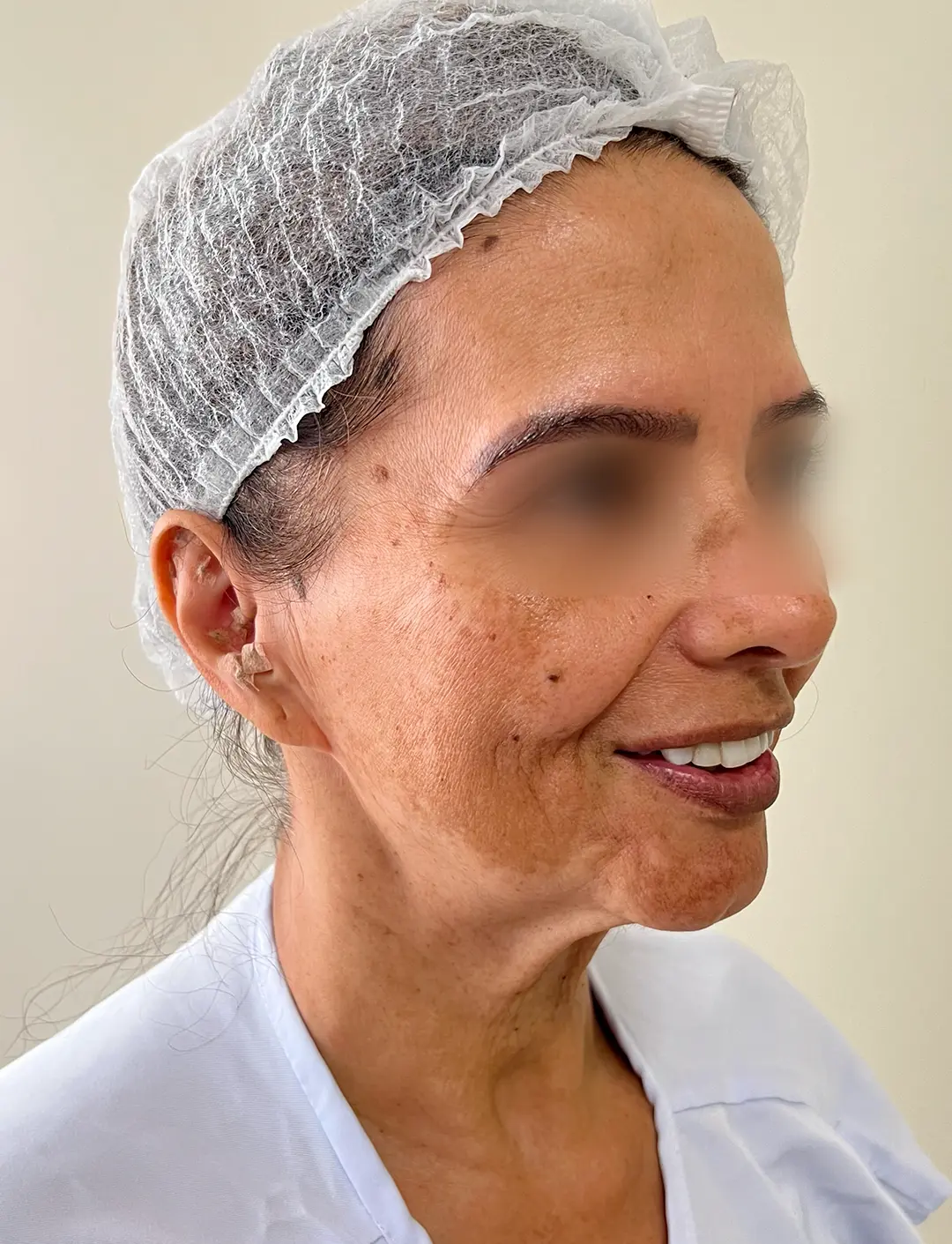 mulher depois mulher depois